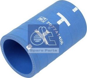 DT Spare Parts 5.45383 - Furtun radiator aaoparts.ro
