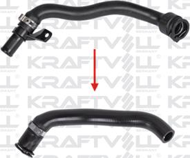 KRAFTVOLL GERMANY 10034641 - Furtun radiator aaoparts.ro